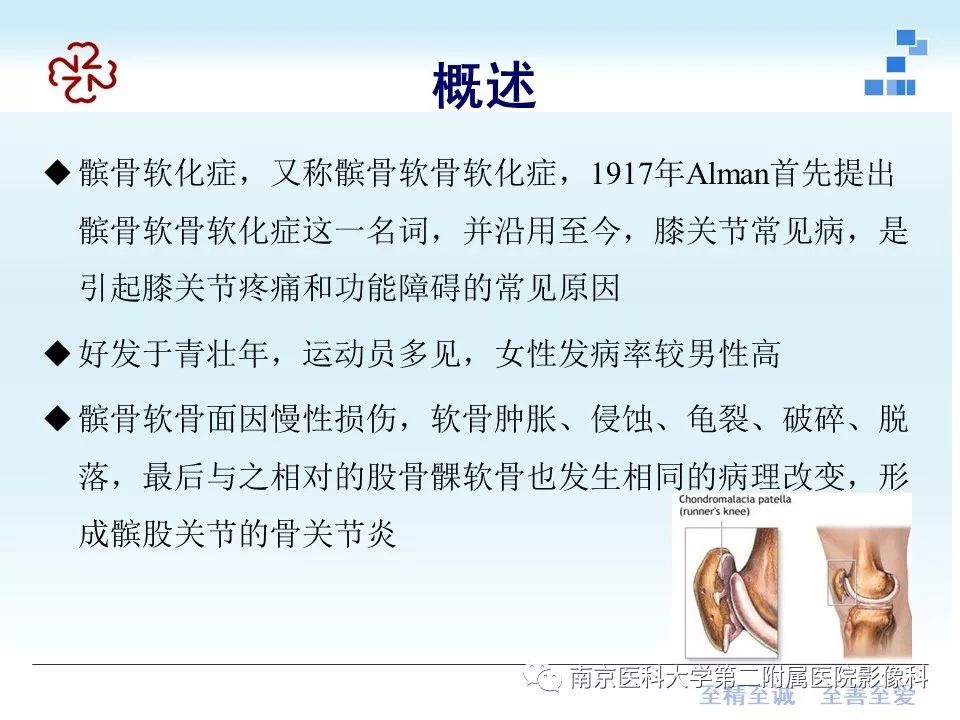 【PPT】髌骨软骨软化症