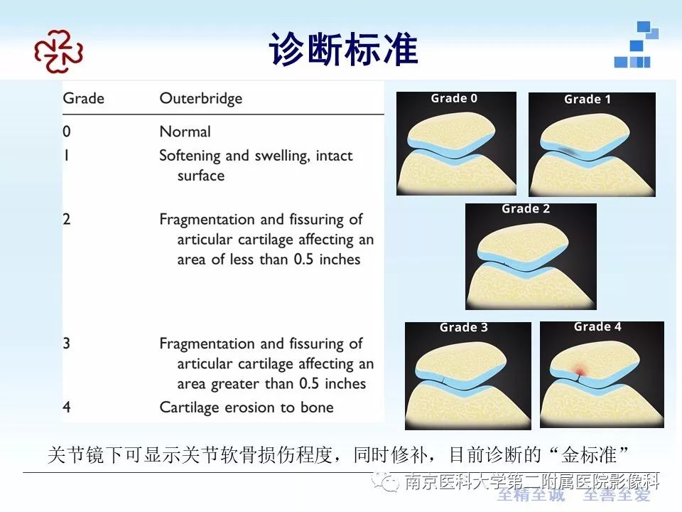 【PPT】髌骨软骨软化症