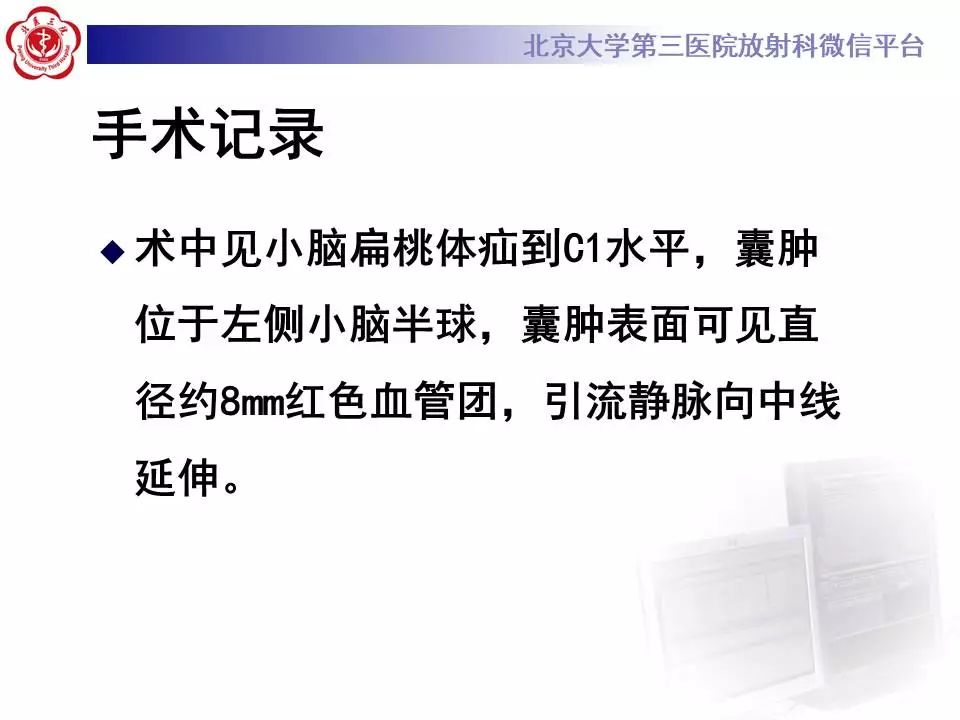 【病例】小脑血管母细胞瘤1例MR影像表现