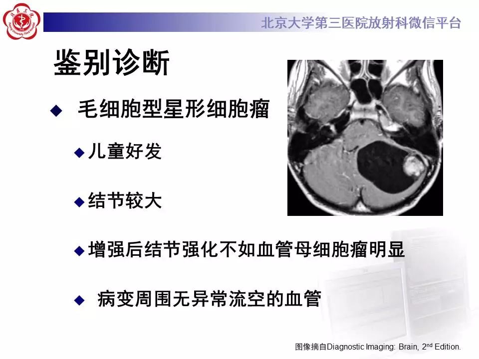 【病例】小脑血管母细胞瘤1例MR影像表现