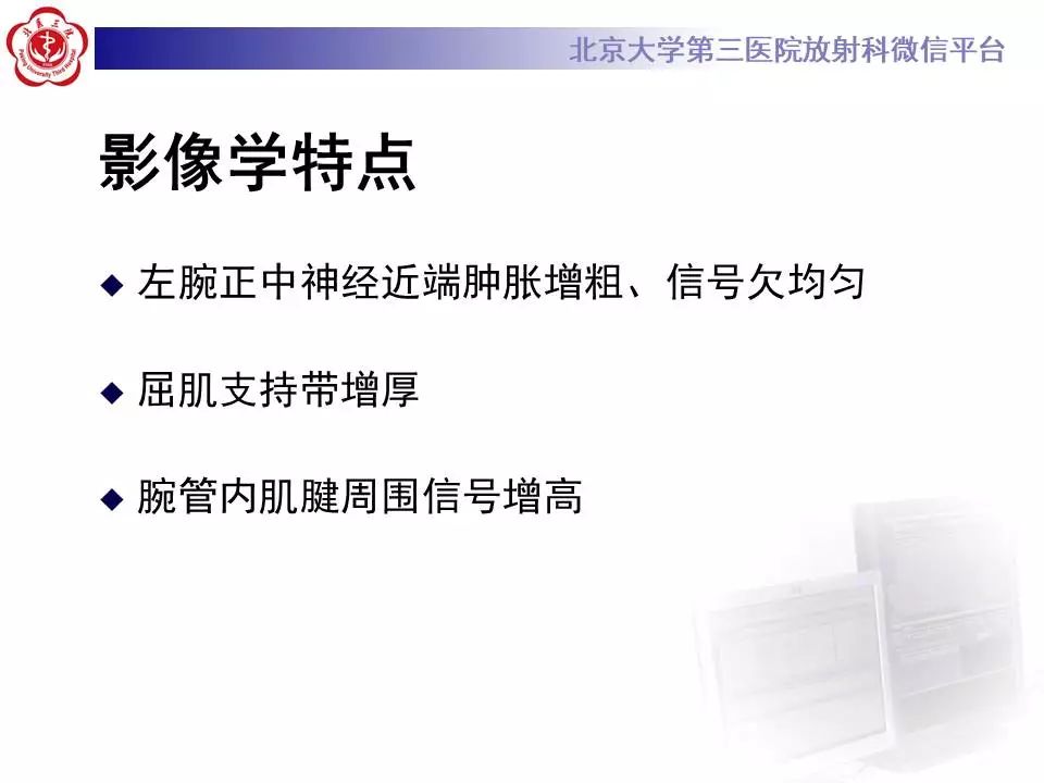 【病例】腕管综合征1例MR影像表现