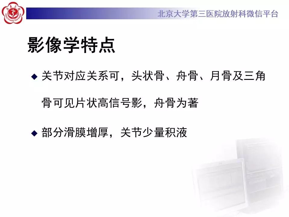 【病例】腕管综合征1例MR影像表现