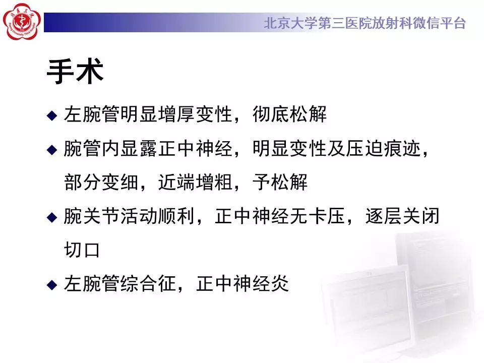 【病例】腕管综合征1例MR影像表现