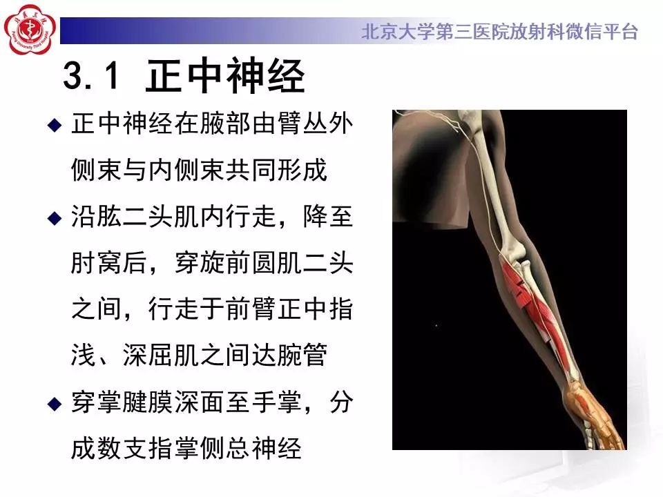 【病例】腕管综合征1例MR影像表现