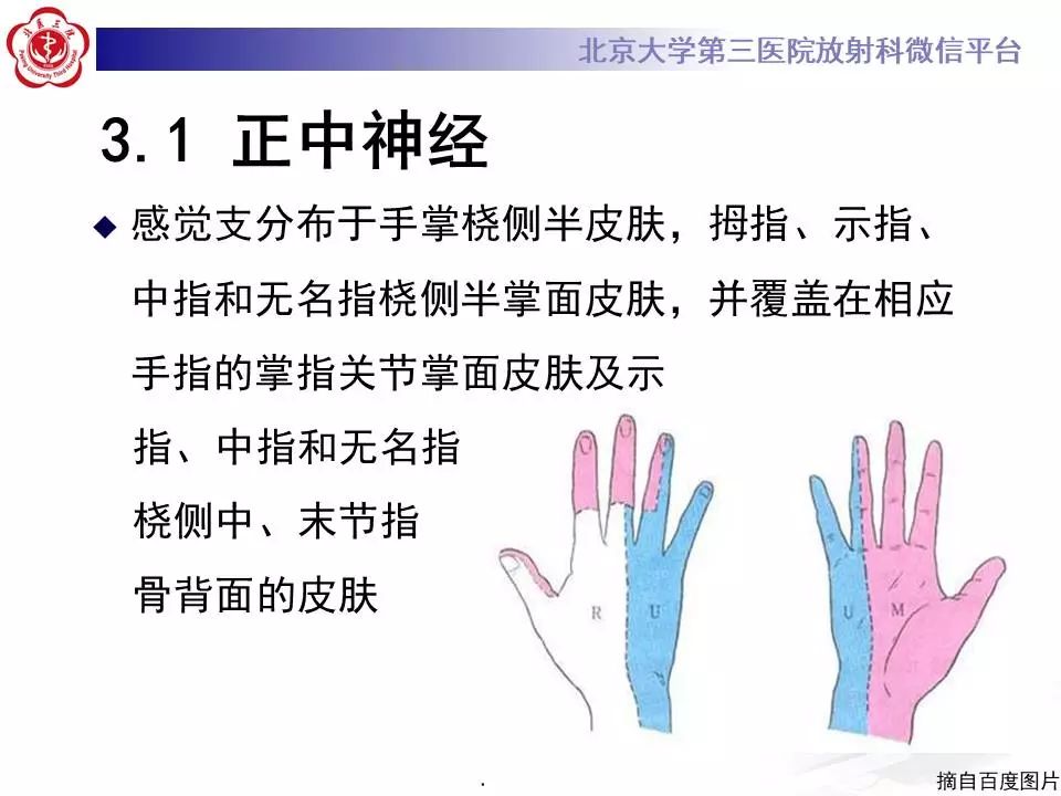【病例】腕管综合征1例MR影像表现