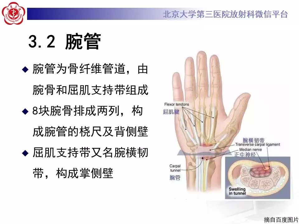 【病例】腕管综合征1例MR影像表现