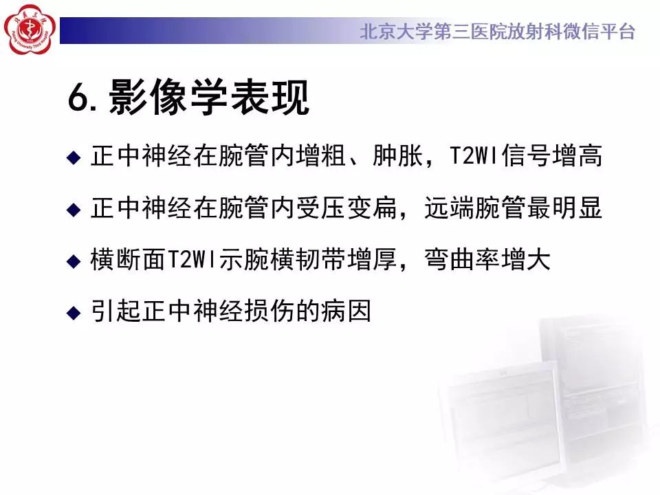 【病例】腕管综合征1例MR影像表现