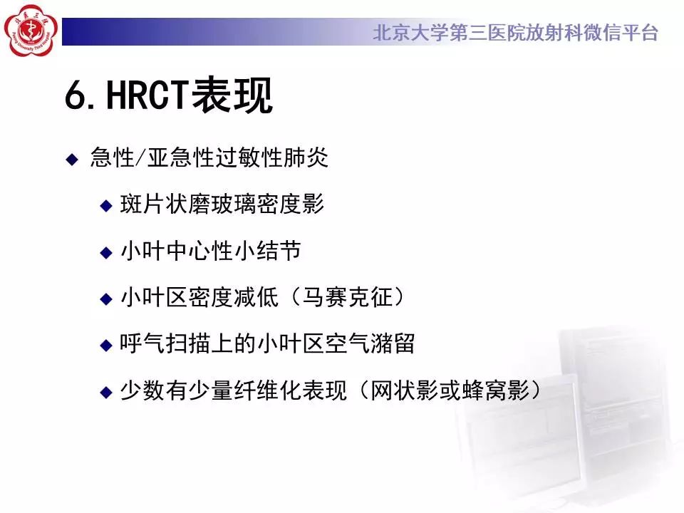 【病例】过敏性肺炎1例CT影像表现