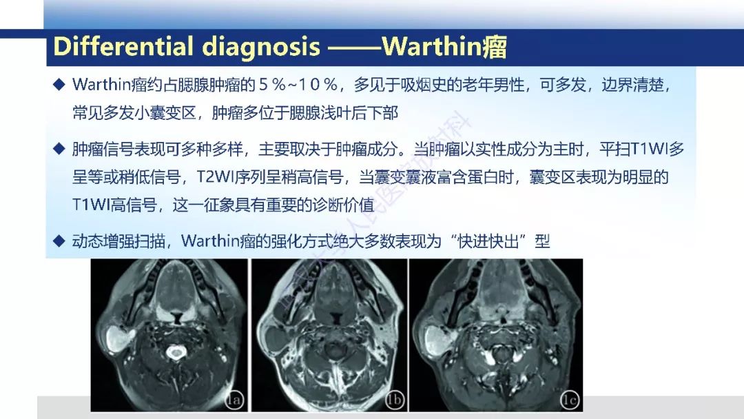 【PPT】涎腺淋巴上皮癌影像诊断