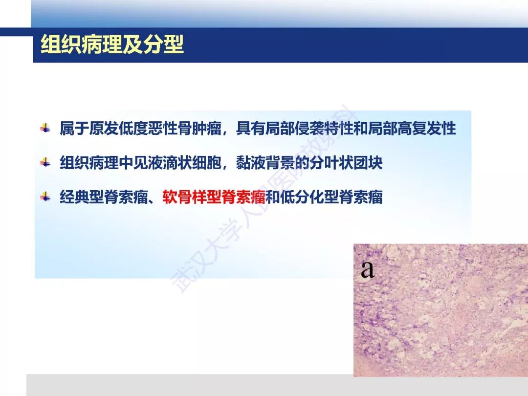 【PPT】颅底软骨样脊索瘤影像诊断