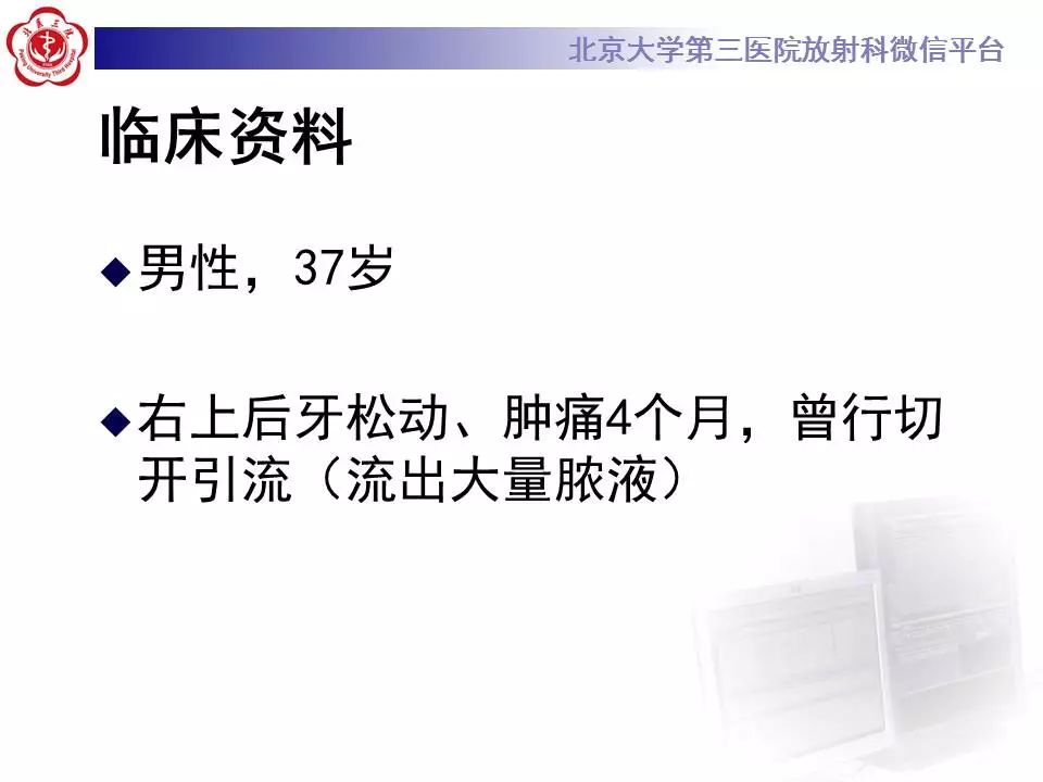 【病例】上颌骨成釉细胞瘤1例CT影像表现