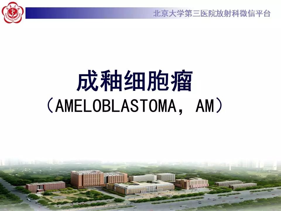 【病例】上颌骨成釉细胞瘤1例CT影像表现