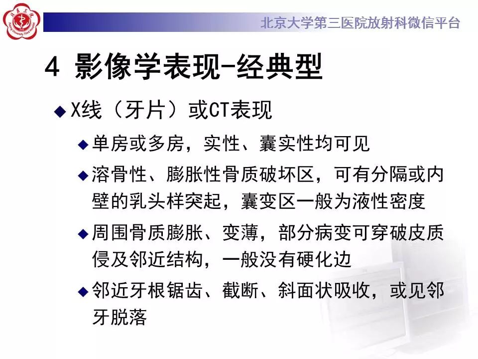 【病例】上颌骨成釉细胞瘤1例CT影像表现