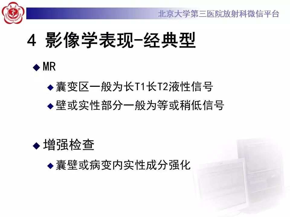 【病例】上颌骨成釉细胞瘤1例CT影像表现