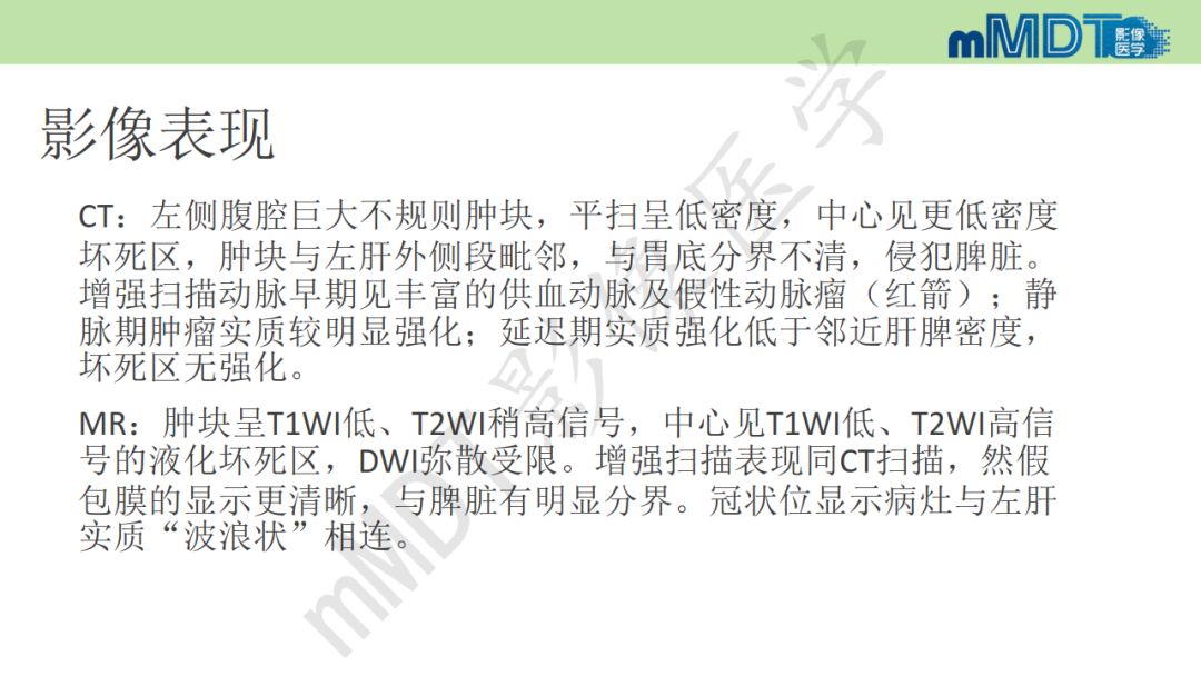 【PPT】特殊类型的肝细胞癌