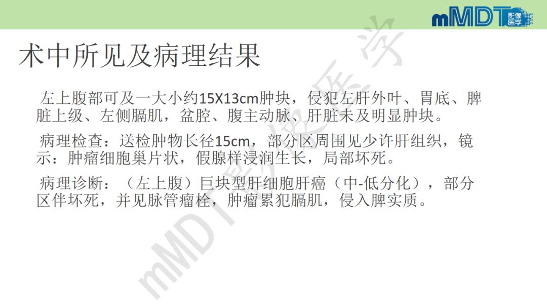 【PPT】特殊类型的肝细胞癌