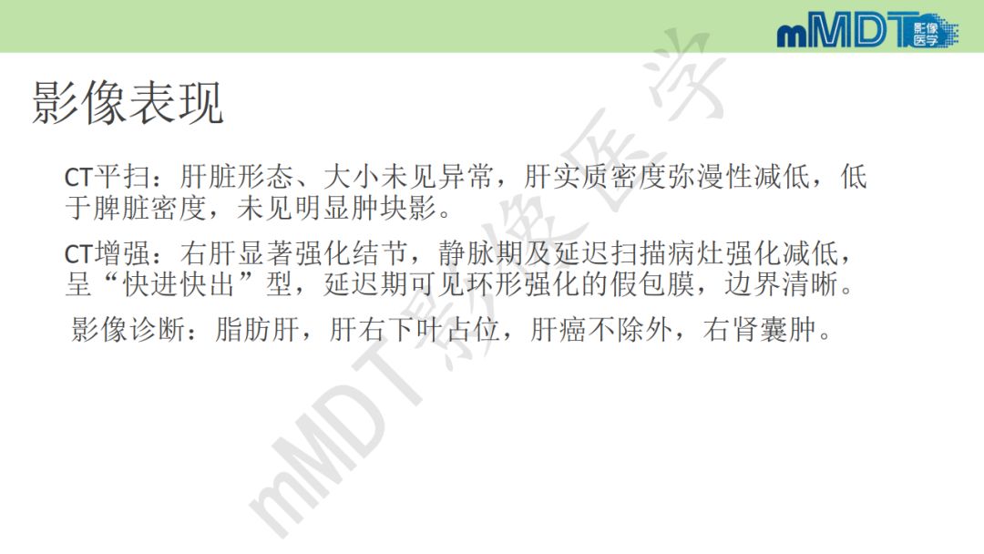 【PPT】特殊类型的肝细胞癌