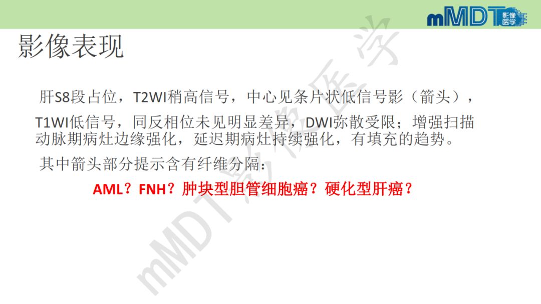 【PPT】特殊类型的肝细胞癌
