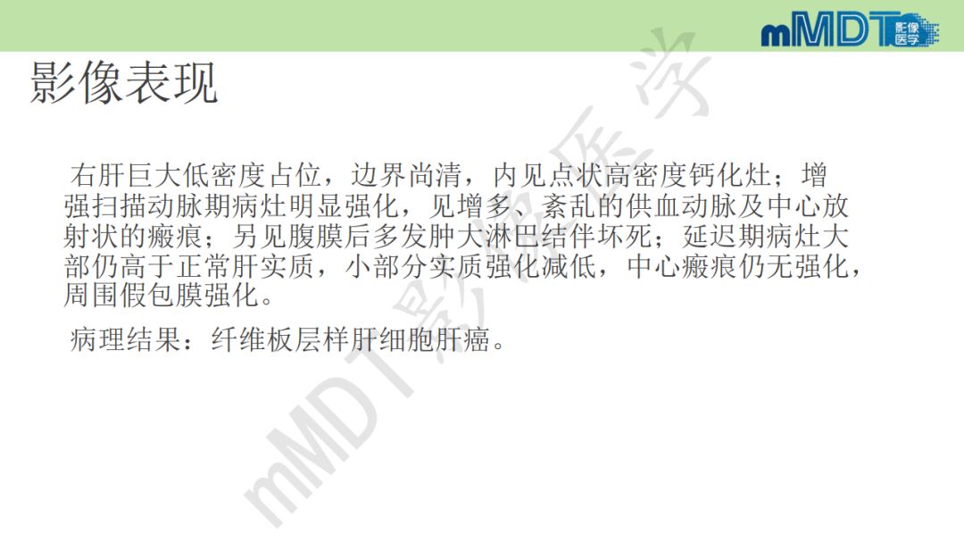 【PPT】特殊类型的肝细胞癌