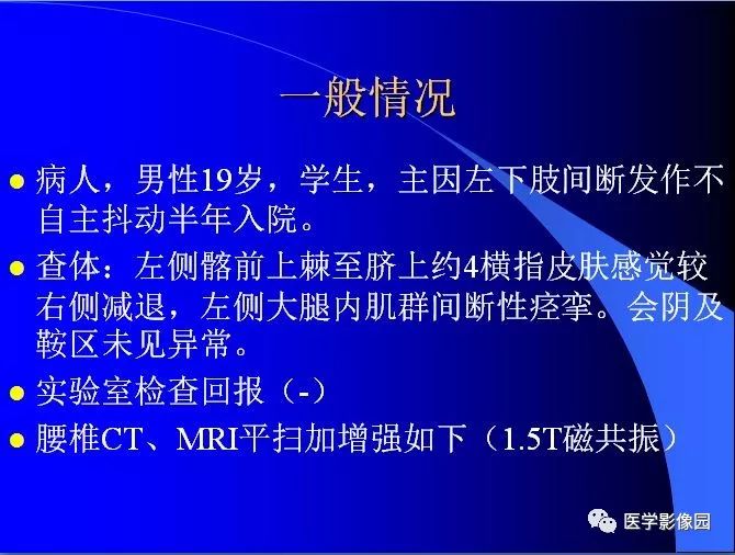 【病例】椎管内囊性占位—皮样囊肿1例MR影像表现