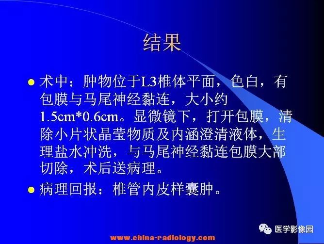 【病例】椎管内囊性占位—皮样囊肿1例MR影像表现