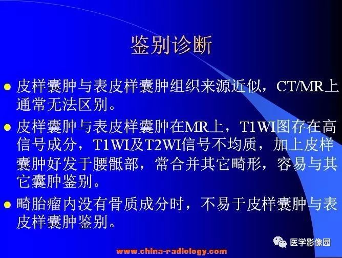 【病例】椎管内囊性占位—皮样囊肿1例MR影像表现
