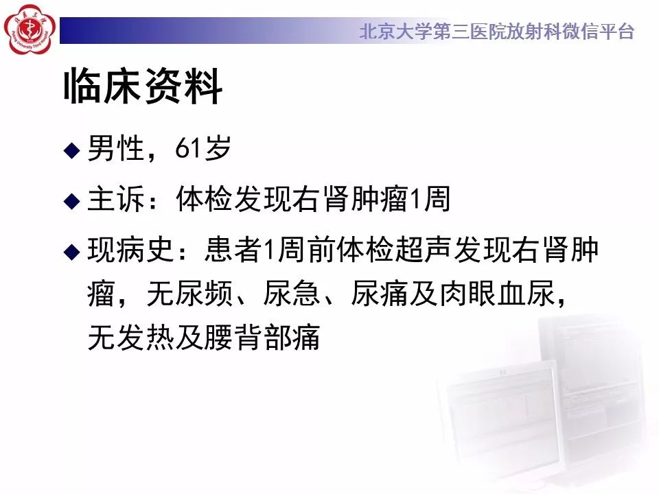 【病例】肾脏嫌色细胞癌1例CT影像表现
