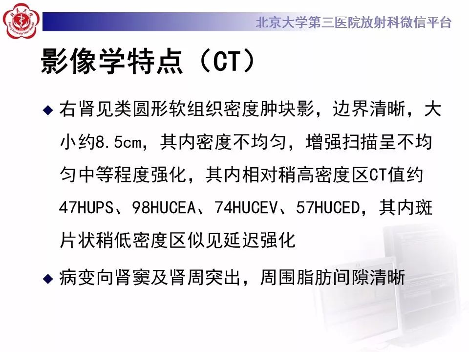 【病例】肾脏嫌色细胞癌1例CT影像表现