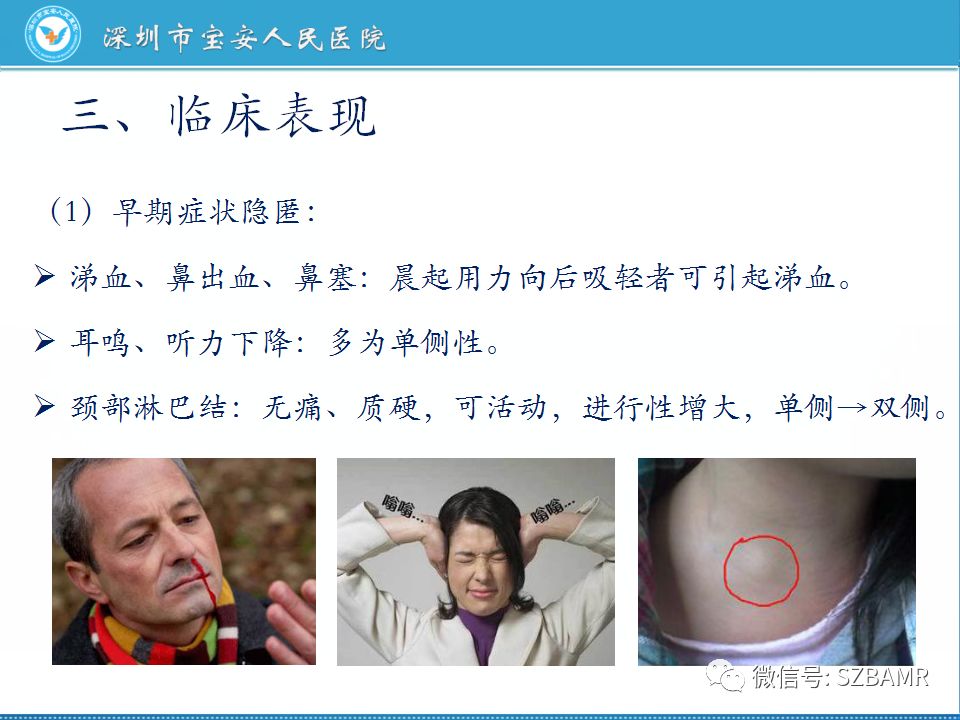 【PPT】鼻咽癌影像诊断