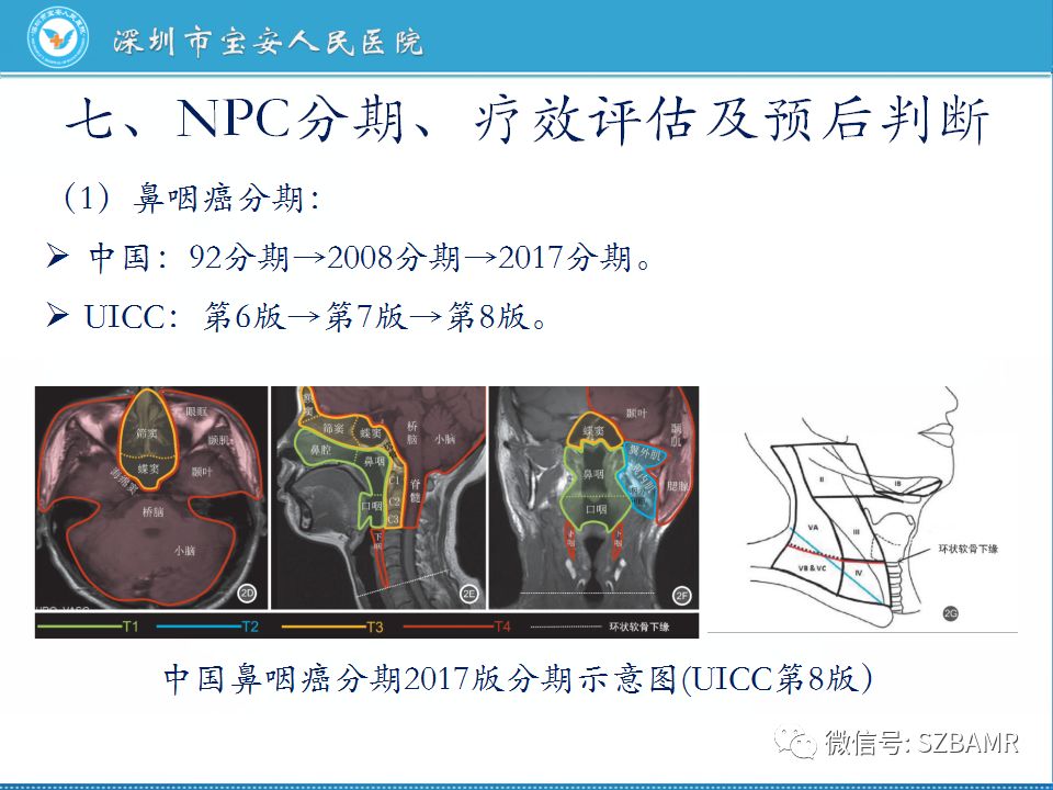 【PPT】鼻咽癌影像诊断