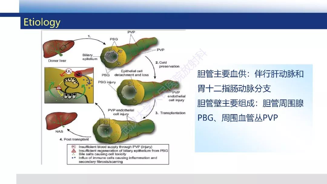 【PPT】胆汁瘤影像诊断与临床