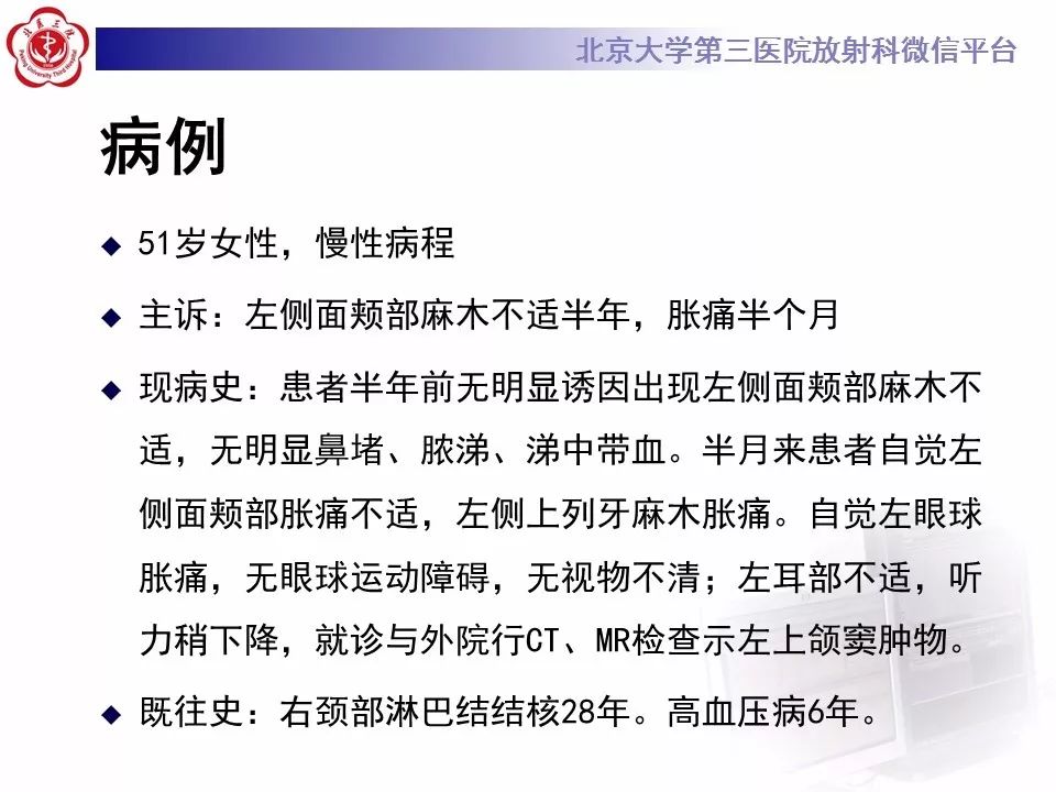 【病例】上颌窦平滑肌肉瘤1例CT及MR影像表现