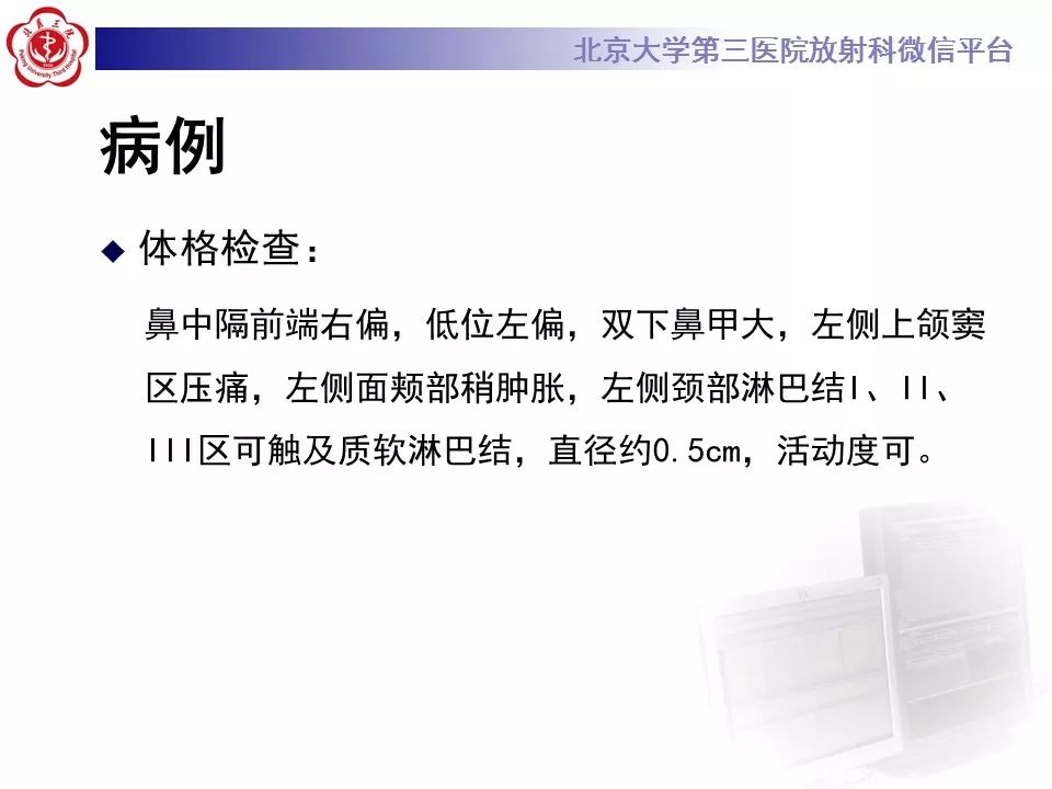 【病例】上颌窦平滑肌肉瘤1例CT及MR影像表现