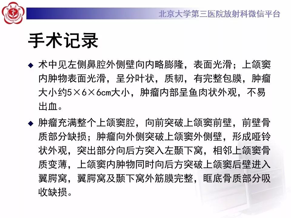 【病例】上颌窦平滑肌肉瘤1例CT及MR影像表现