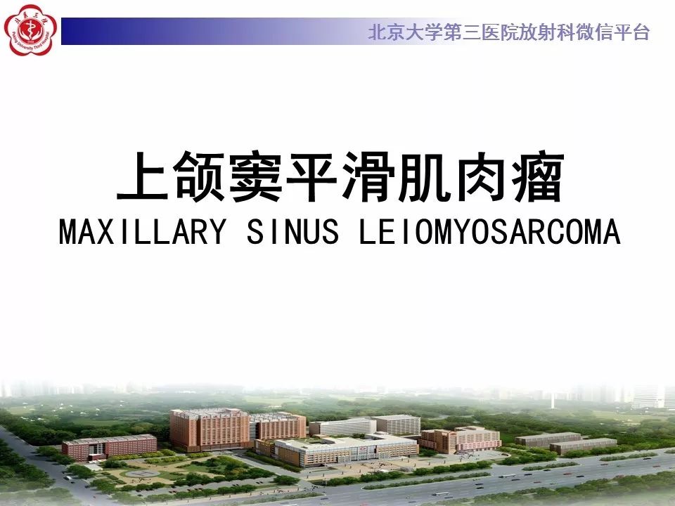 【病例】上颌窦平滑肌肉瘤1例CT及MR影像表现