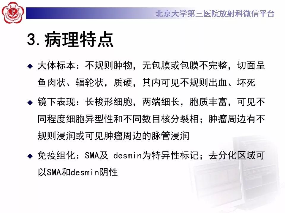 【病例】上颌窦平滑肌肉瘤1例CT及MR影像表现