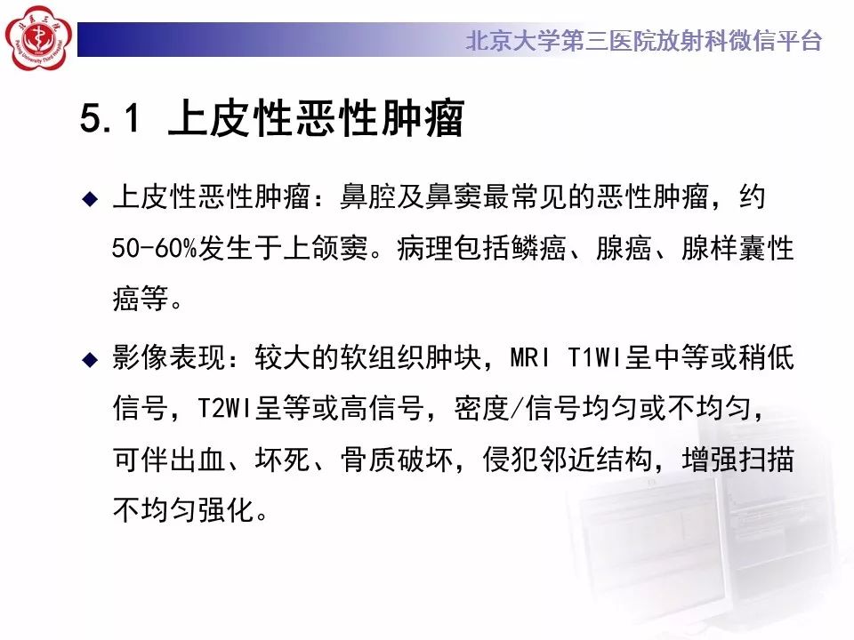 【病例】上颌窦平滑肌肉瘤1例CT及MR影像表现