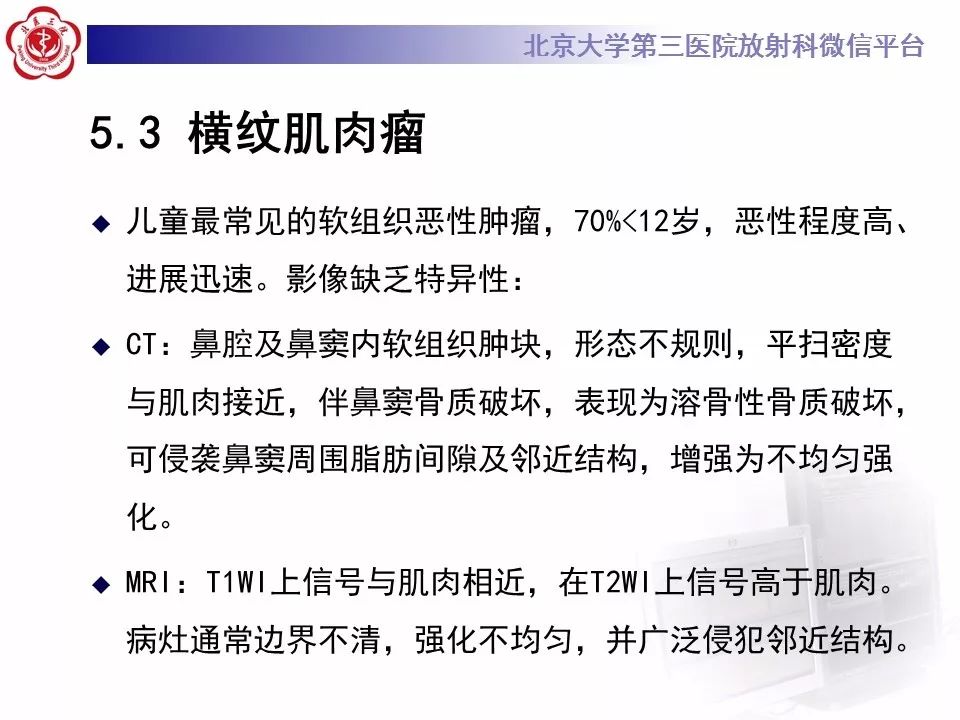 【病例】上颌窦平滑肌肉瘤1例CT及MR影像表现