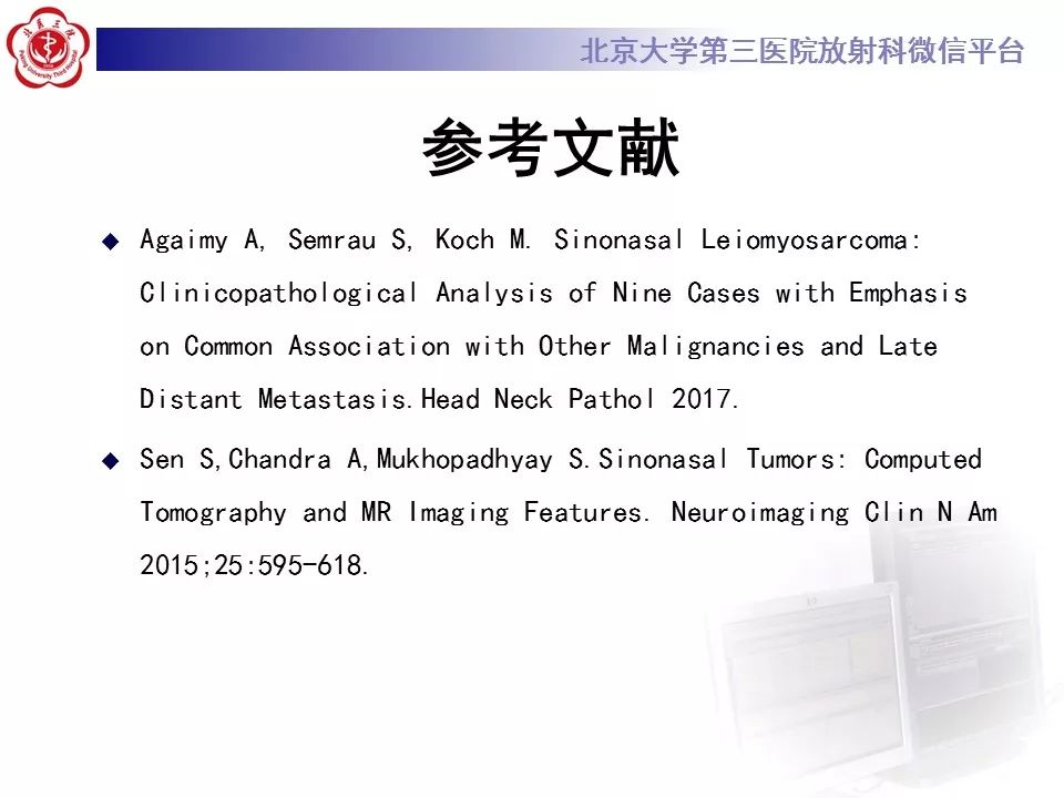 【病例】上颌窦平滑肌肉瘤1例CT及MR影像表现