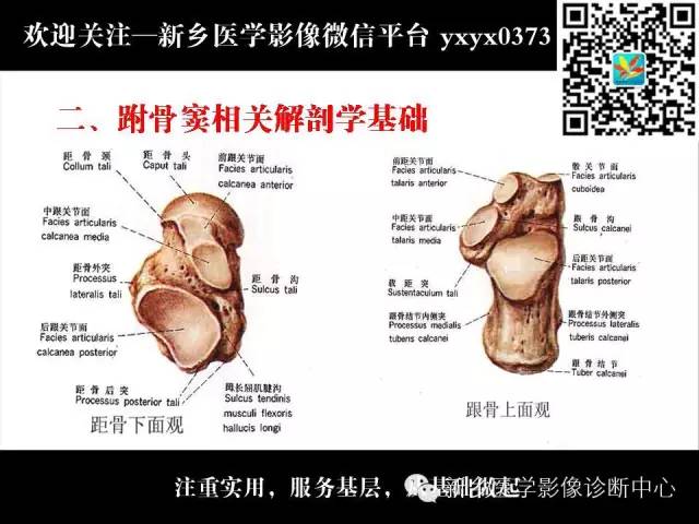 【PPT】跗骨窦综合征的影像表现