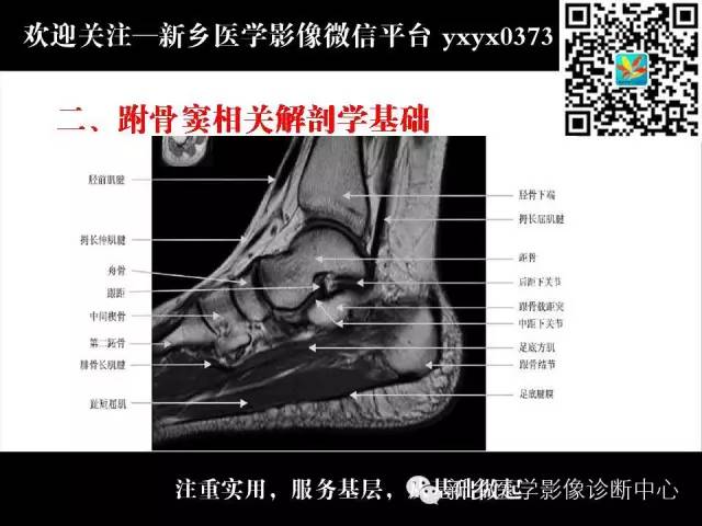 【PPT】跗骨窦综合征的影像表现