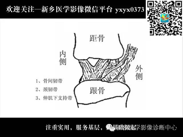 【PPT】跗骨窦综合征的影像表现