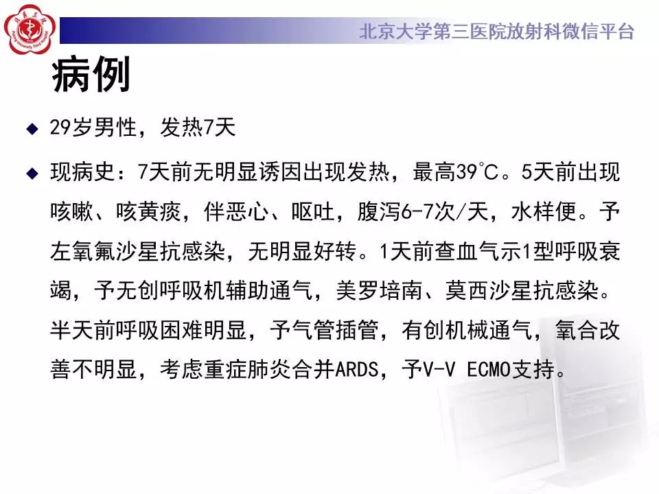 【病例】甲型流感性病毒性肺炎1例CT影像表现