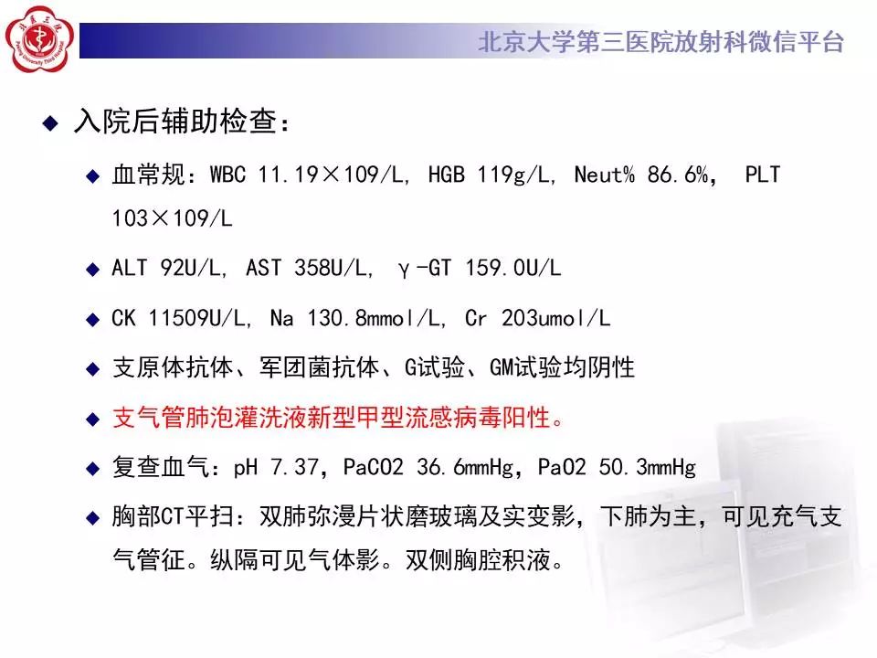 【病例】甲型流感性病毒性肺炎1例CT影像表现