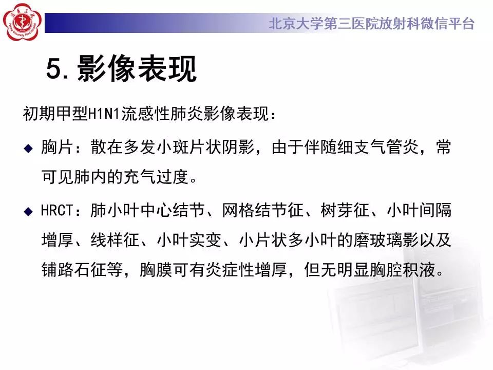 【病例】甲型流感性病毒性肺炎1例CT影像表现