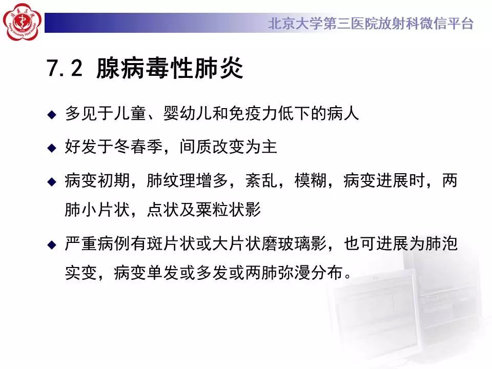 【病例】甲型流感性病毒性肺炎1例CT影像表现