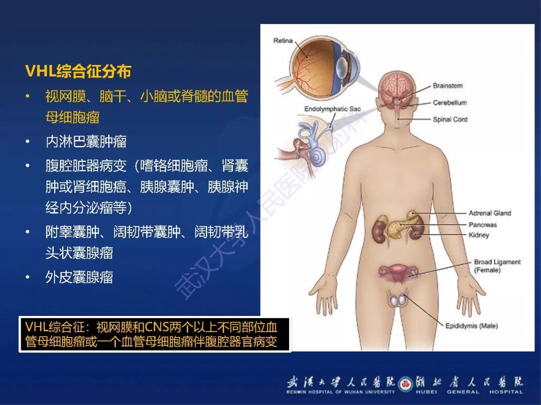 【PPT】耳内淋巴囊肿瘤影像诊断