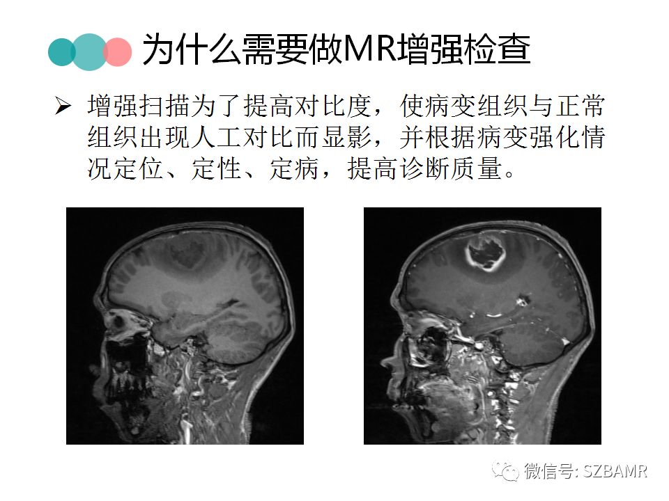 【PPT】MRI对比剂与肾源性系统纤维化