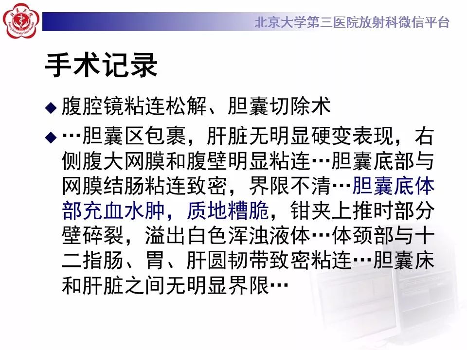 【病例】黄色肉芽肿性胆囊炎1例CT影像表现