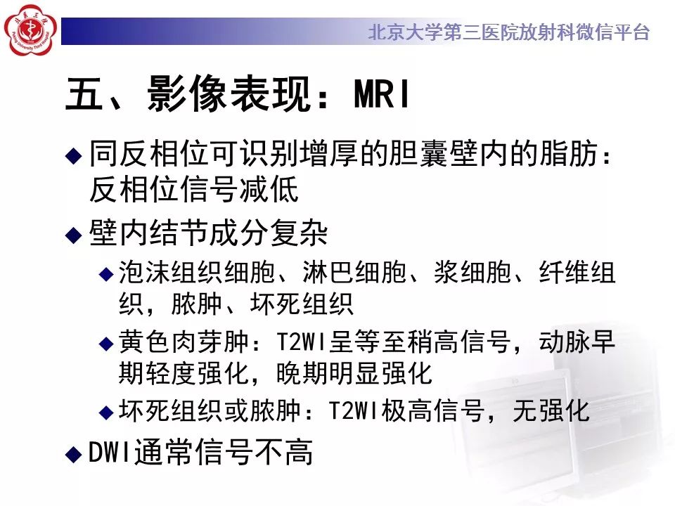 【病例】黄色肉芽肿性胆囊炎1例CT影像表现